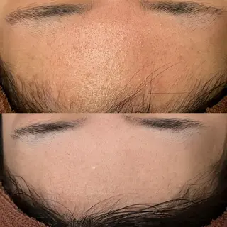 ニキビ・肌質改善専門 ♡人生が変わるサロンのエステ・リラクイメージ