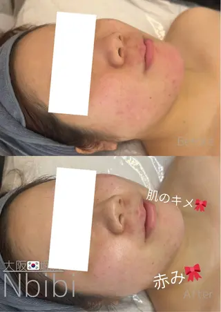 韓国🇰🇷価格 サロン_Nbibiのエステ・リラクイメージ