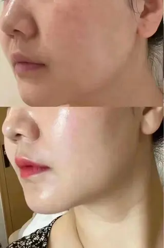 マツエク・マツパ aliaハイフ&水光ジェットサロン所属・aliaハーブ水光店 エステティシャン募集のエステ・リラクイメージ