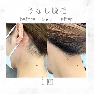 エステサロンNarcis〜ナルシス〜所属・脱毛＆痩身エステ Narcisのエステ・リラクイメージ