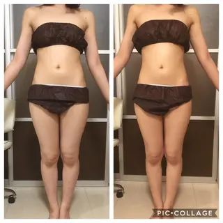 ミディアム カラー パーマ ヘアアレンジ メンズ キッズ ネイル マツエク・マツパ アニメ,Vオタク× 即効痩せエステサロンのエステ・リラクイメージ