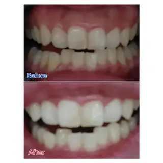 M渋谷店所属・M渋谷 ホワイトニングのエステ・リラクイメージ