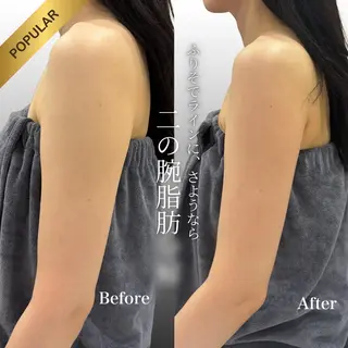 心斎橋🤍堀江.小顔 ハーブ.痩身クレビアのエステ・リラクイメージ