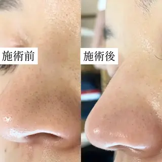 毛穴専門サロン　フルール所属・フルールFululu 自由が丘のエステ・リラクイメージ