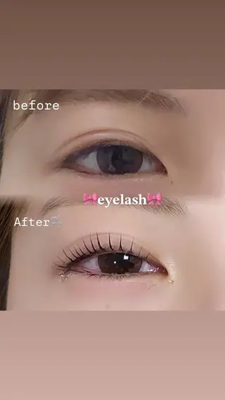 ãããšã¯ã»ããã VIAS rin.âððã®ãããšã¯ã»ããããã¶ã€ã³