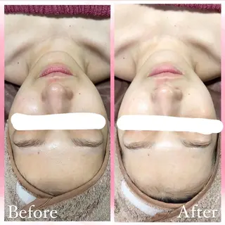 salon〜RePCa〜(サロンルピカ)所属・山﨑 藍のエステ・リラクイメージ