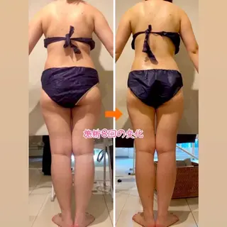 ショート カラー パーマ ヘアアレンジ メンズ キッズ ネイル マツエク・マツパ ‍痩身＆ボディ 結果出し🌟丹野のエステ・リラクイメージ