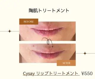 熊澤 里香のエステ・リラクイメージ