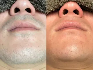 Tug エステサロン　高知駅前店所属・高知駅店Tug NONOKAのエステ・リラクイメージ