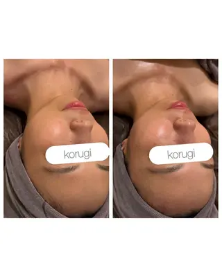 肌質管理/小顔コルギ ☆表参道/外苑前のエステ・リラクイメージ