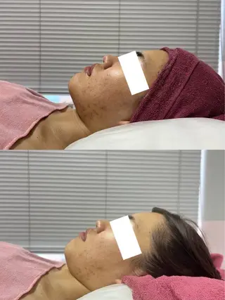 小顔・ツルツル素肌 ハリステリアのエステ・リラクイメージ