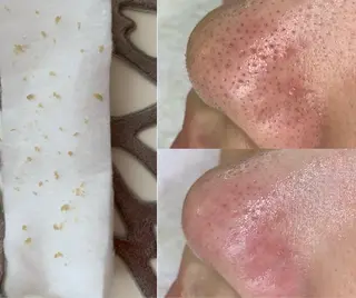 【毛穴専門店】 瑞江|yukaのエステ・リラクイメージ