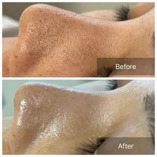 毛穴が見えなくなるサロン  Horo所属・岡 えり子のエステ・リラクイメージ