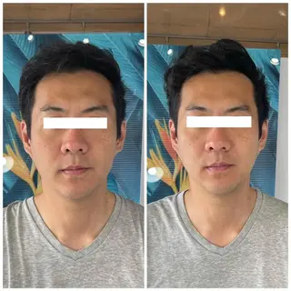 部分痩せ♥️小顔専門 MIKUのエステ・リラクイメージ