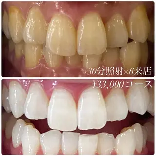 ホワイトニングルーム　川崎店所属・ホワイトニング ルーム　川崎店のその他イメージ