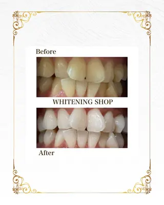 ホワイトニングショップ静岡葵区店所属・ホワイトニング ショップ葵区静岡駅店のその他イメージ