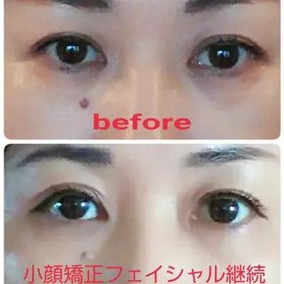 小顔と美肌 まごころエステMatoria所属・小顔 美肌専門 Matoriaのエステ・リラクイメージ