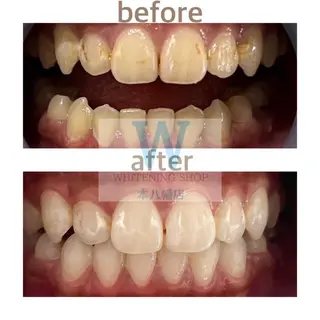 ホワイトニング ショップ本八幡店のエステ・リラクイメージ