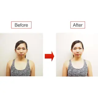 小顔ハーブピーリング 美容鍼/毛穴洗浄のエステ・リラクイメージ