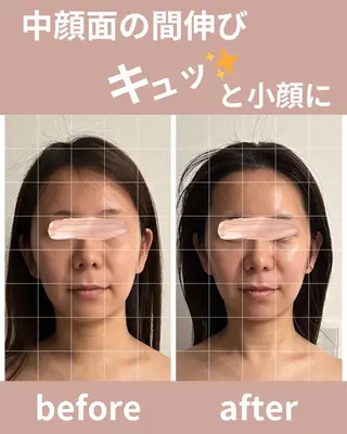 小顔造り• relaxationのエステ・リラクイメージ