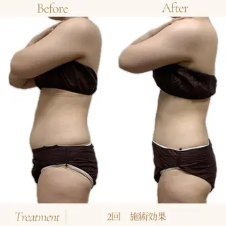 coco salon sou.所属・佐藤 由依のエステ・リラクイメージ