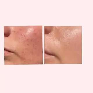 フェイシャルサロン ステラのエステ・リラクイメージ