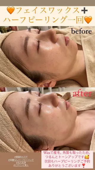 メンズ Salon de Lino 御器所のエステ・リラクイメージ