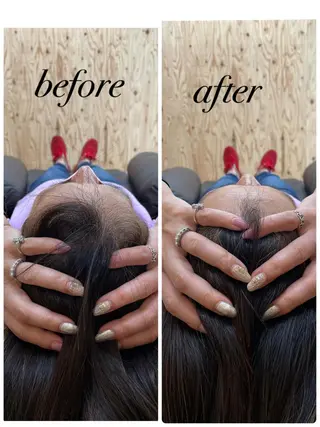 ate'所属・個室ドライヘッドスパ 🍃moriのエステ・リラクイメージ