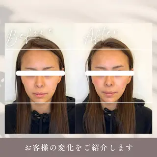 小顔矯正&美容整体 整え屋REDオーナーのエステ・リラクイメージ