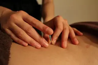 小顔矯正・美容鍼 美鍼堂のエステ・リラクイメージ