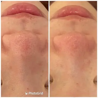 💚THE BALM 金子💚✨のエステ・リラクイメージ