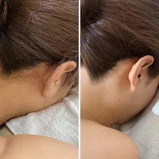 うなじ脱毛/美肌脱毛 LABELのエステ・リラクイメージ