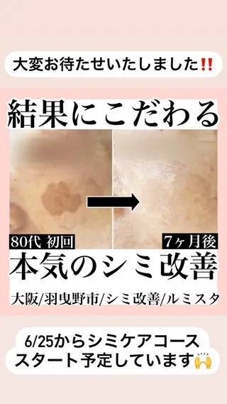 シミケア放題専門 /杉原いくえのエステ・リラクイメージ