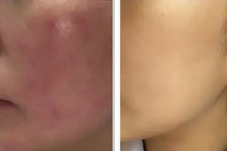 ニキビ毛穴専門店Beautysalon Luana所属・小林 まいのエステ・リラクイメージ