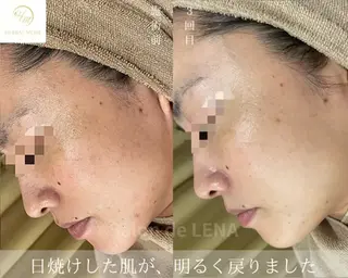 Grandir所属・ハーブピーリング専門 グランディール　武内のエステ・リラクイメージ