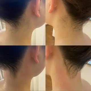 BELCIA福岡店　récolte de BELCIA（レコルトデベルシア）所属・BELCIA福岡店 レコルトデベルシアのエステ・リラクイメージ