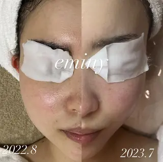 EMINY （エステティシャン）のエステ・リラクイメージ