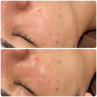 立体小顔×艶肌×美ボ ディ似合わせ施術 岡のエステ・リラクイメージ