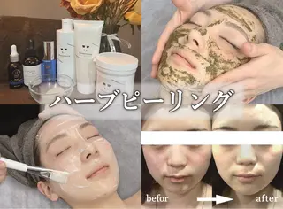 肌質改善専門 ハーブ /毛穴洗浄 リエイトのエステ・リラクイメージ