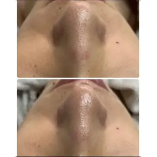 トラブル肌専門店 プレイス天王寺店のエステ・リラクイメージ