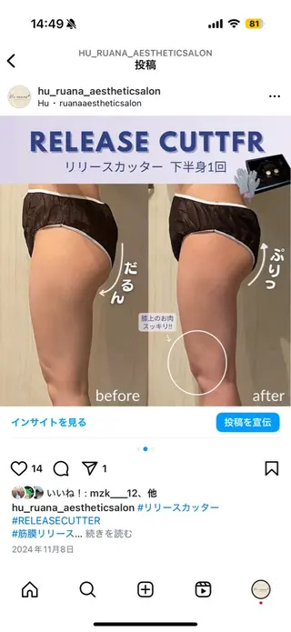 Hu.ruana AWANOのエステ・リラクイメージ