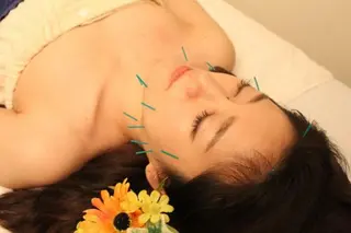 小顔矯正・美容鍼 美鍼堂のエステ・リラクイメージ