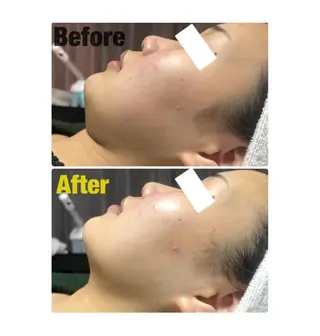 ROR Akariのエステ・リラクイメージ