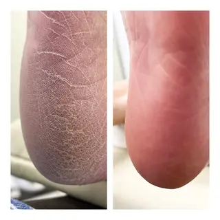 Bella  totalbeauty所属・Bella 齋藤理奈のネイルデザイン