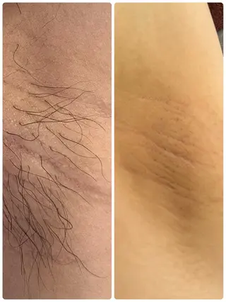 【Resetlab】 Chihiroのエステ・リラクイメージ