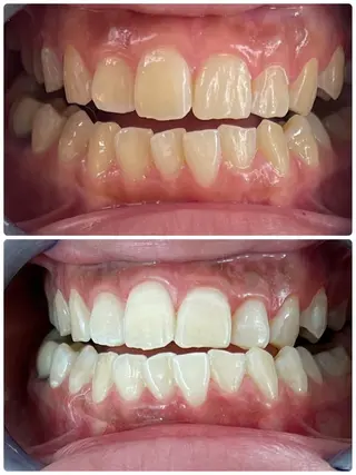 セルフホワイトニング エクシア徳島店マユのその他イメージ