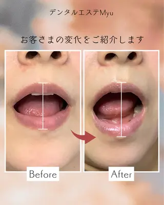 Myu所属・Suzuki Yumiのエステ・リラクイメージ