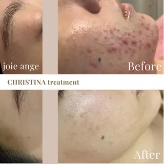 フェイシャル/脱毛 ジョアアンジェ さきのエステ・リラクイメージ