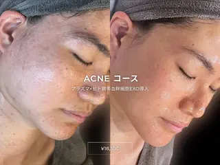 CURATED SKIN｜神戸三宮のエステ・リラクイメージ