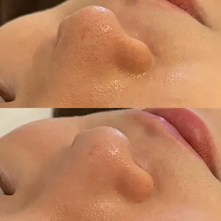 C'ies Esthetic Salon所属・CHIAKI ♪のエステ・リラクイメージ